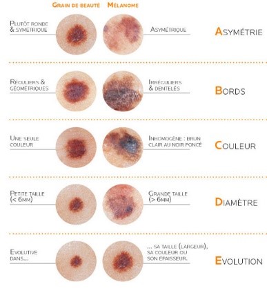 abcde METHODE CANCER PEAU