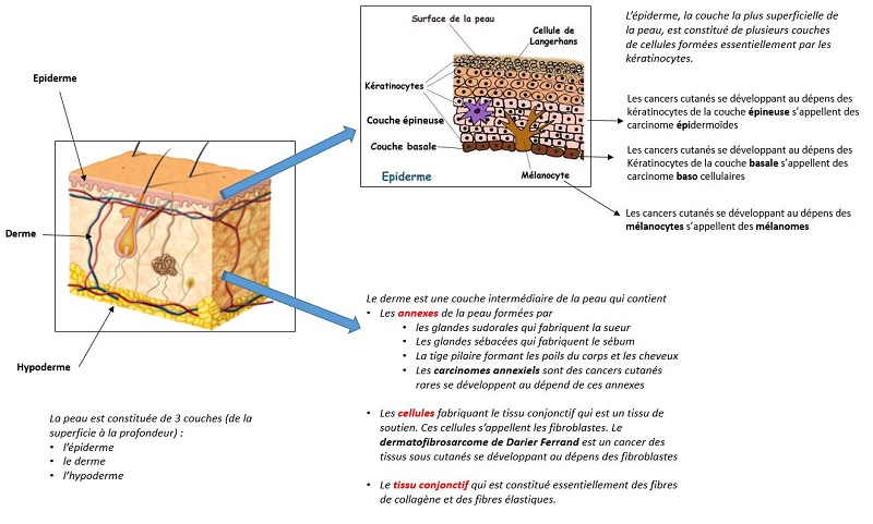 cancer peau schema