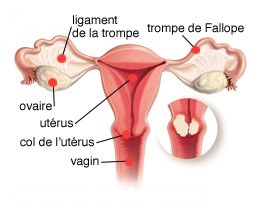 Cancer du col de l'utérus | Centre Léon Bérard Lyon