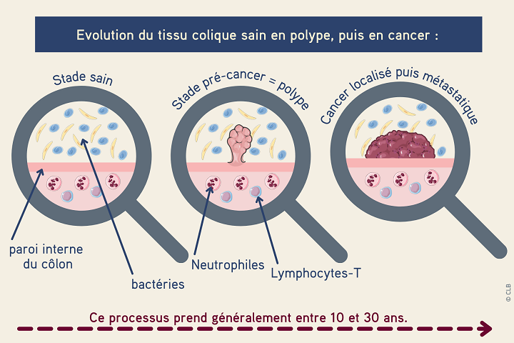 EVOLUTION POLYPE