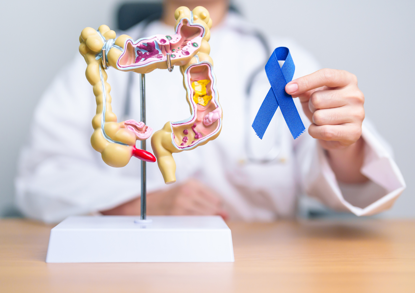 prévention cancer colorectal 