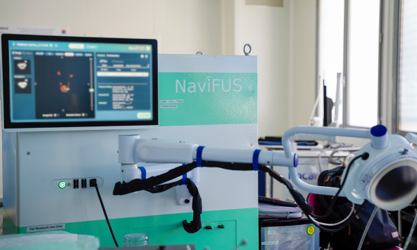 Le dispositif NaviFUS