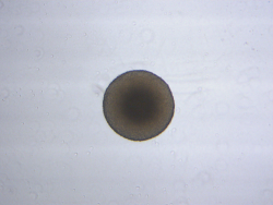 organoide