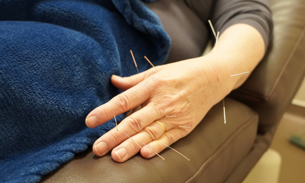 main acupuncture