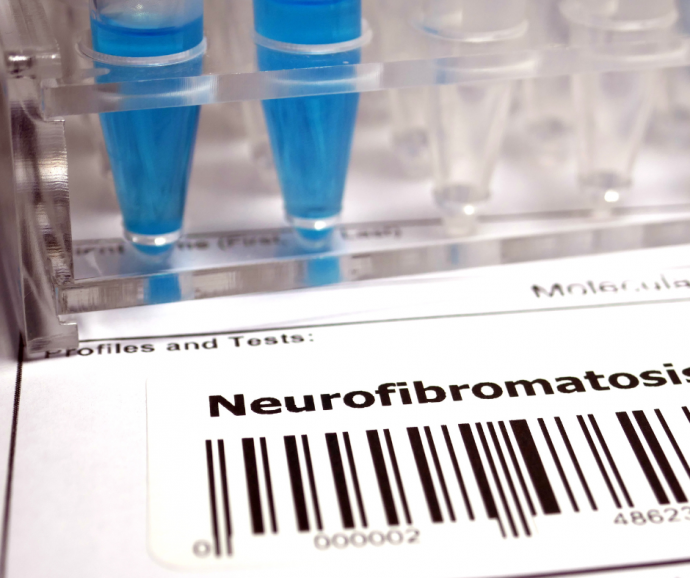 neurofibromatose