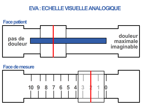 Echelle de la douleur