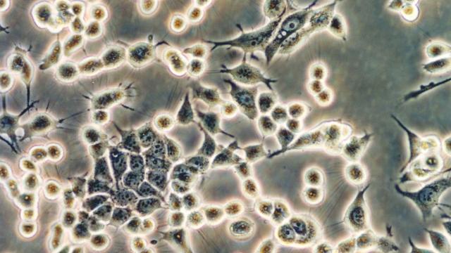 Images de cellules cancéreuses